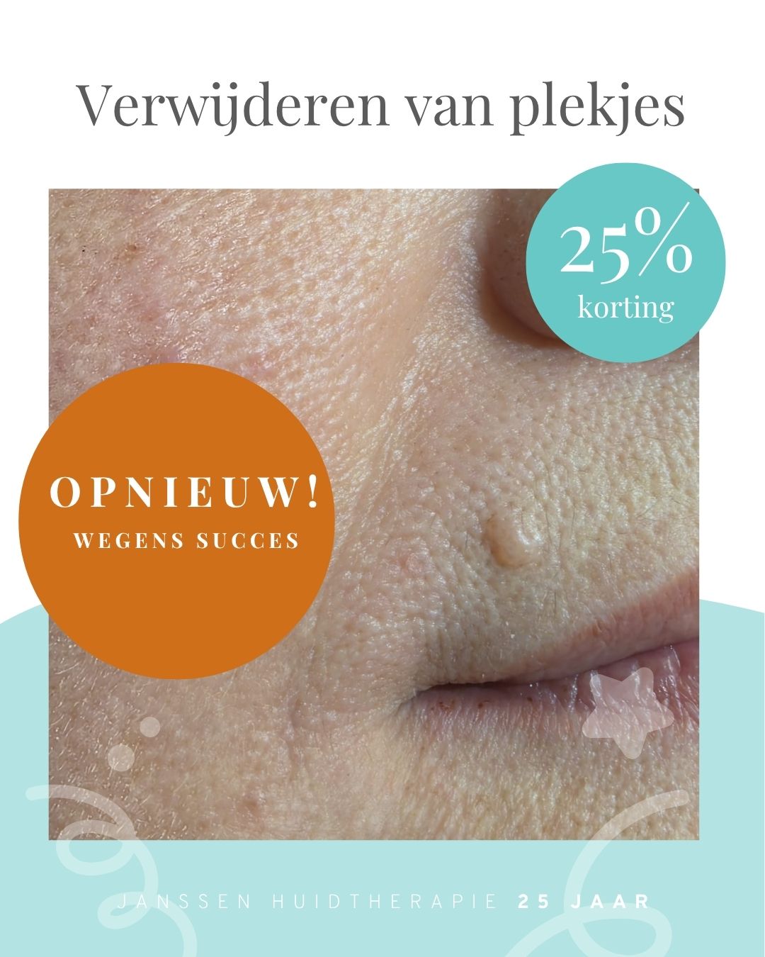 Actie 2