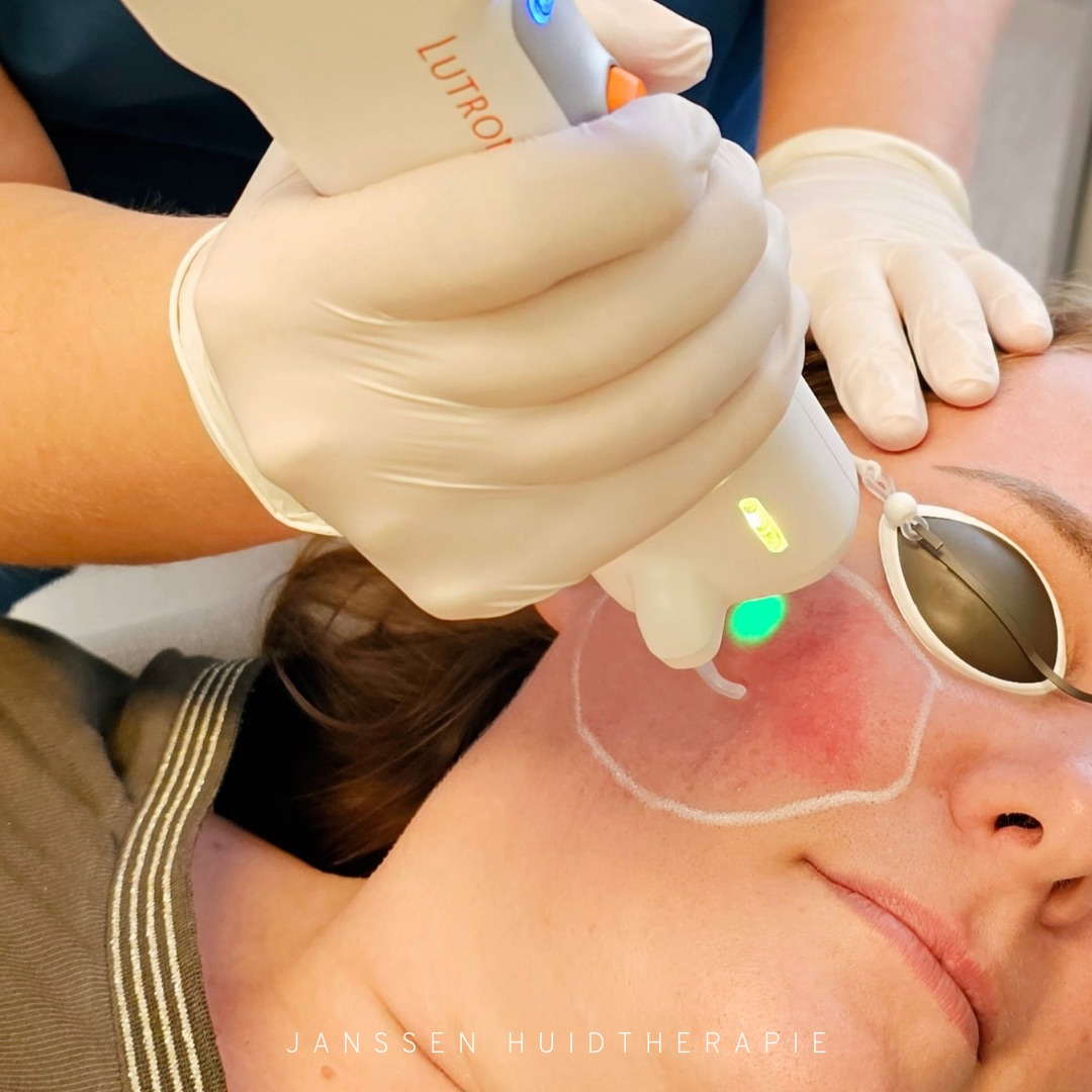 JANSSEN HUIDTHERAPIE-57